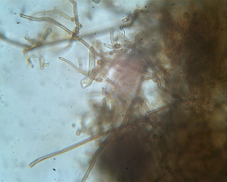 Corticiacea ospitale